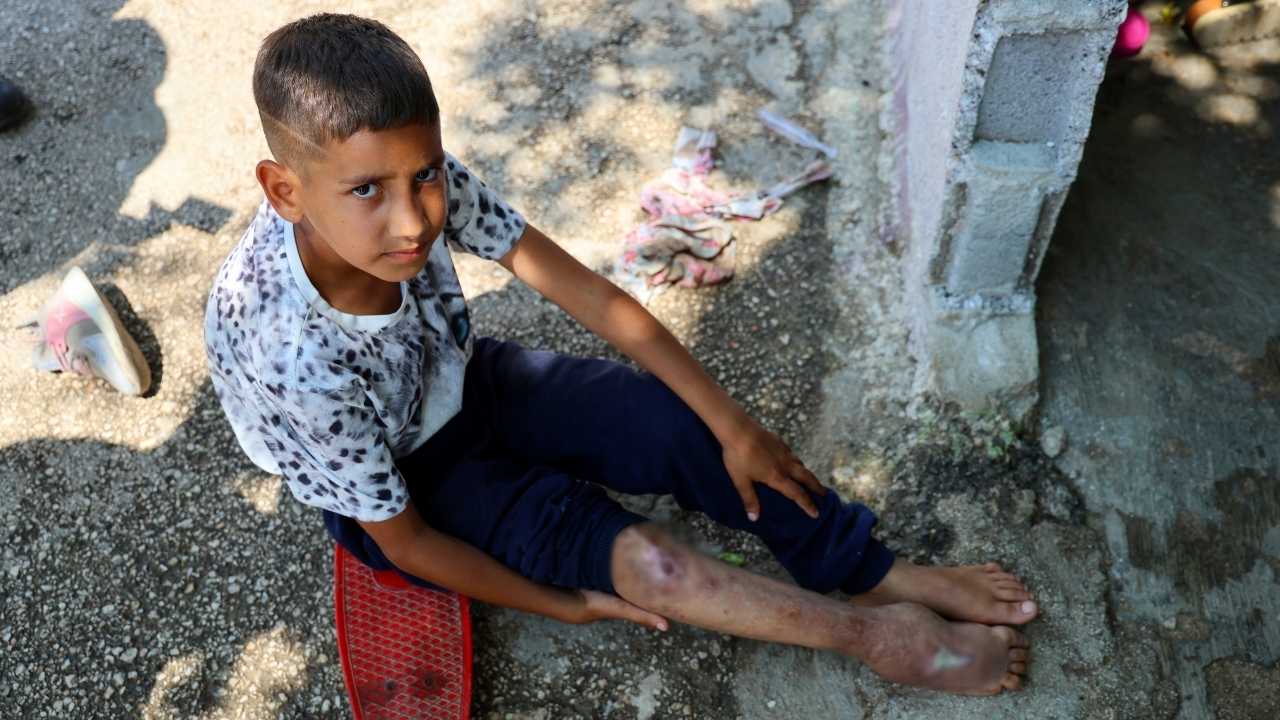Adana’da Minik Serdal Yaşıtları Gibi Okula Gitmek İstiyor 2
