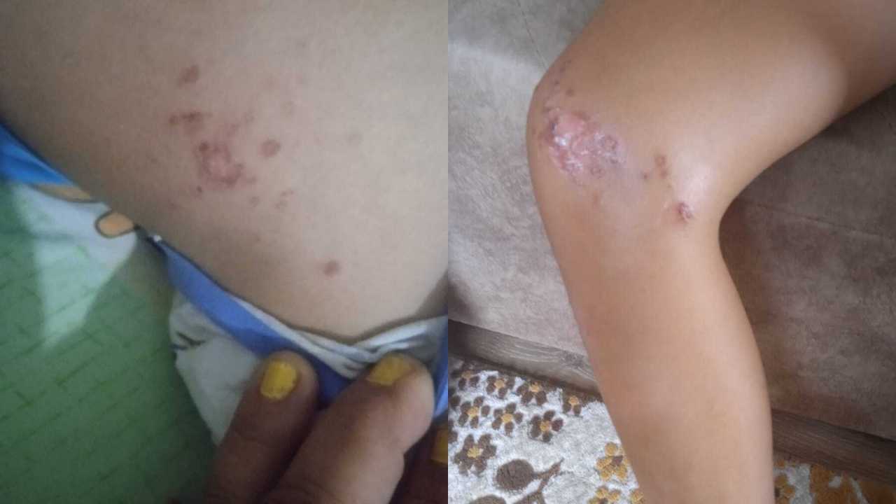 Gazipaşa Denizinde Enfeksiyon Tehlikesi Vatandaşları Korkutuyor 3