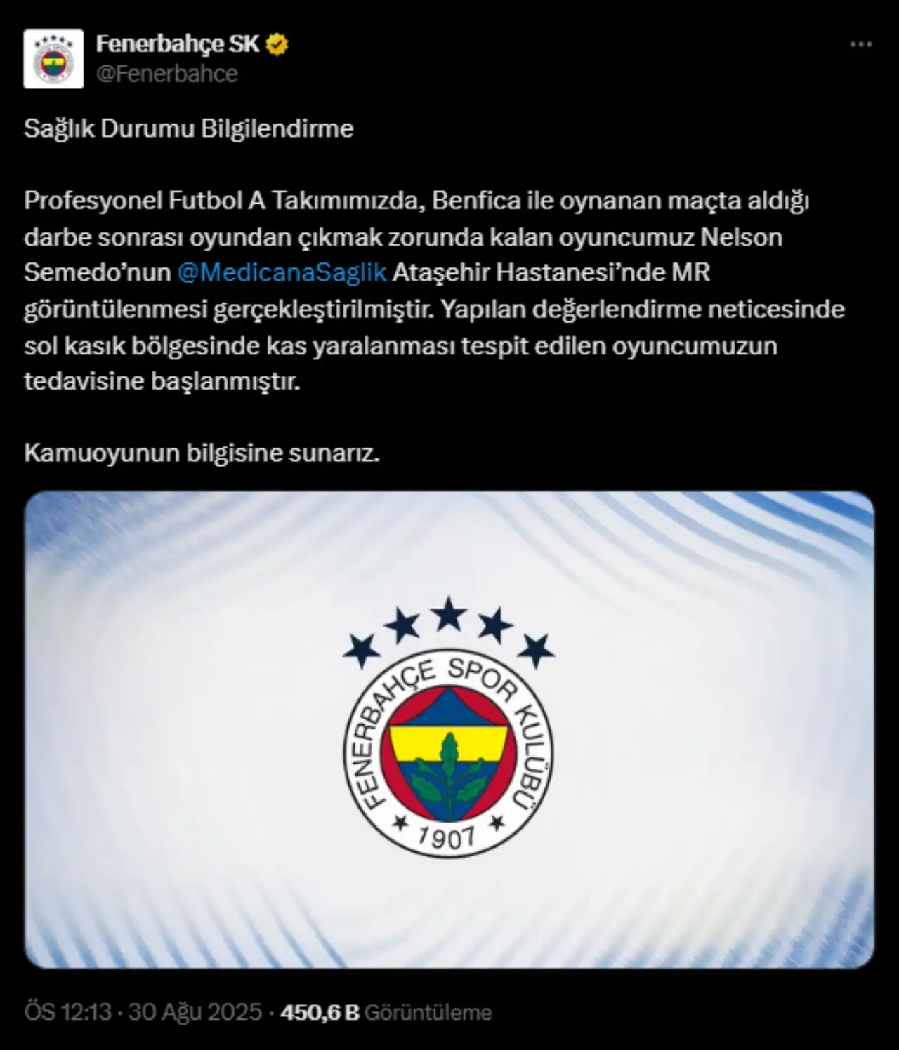 fenerbahceye-kotu-haber-semedo-sakatlandi-2.webp