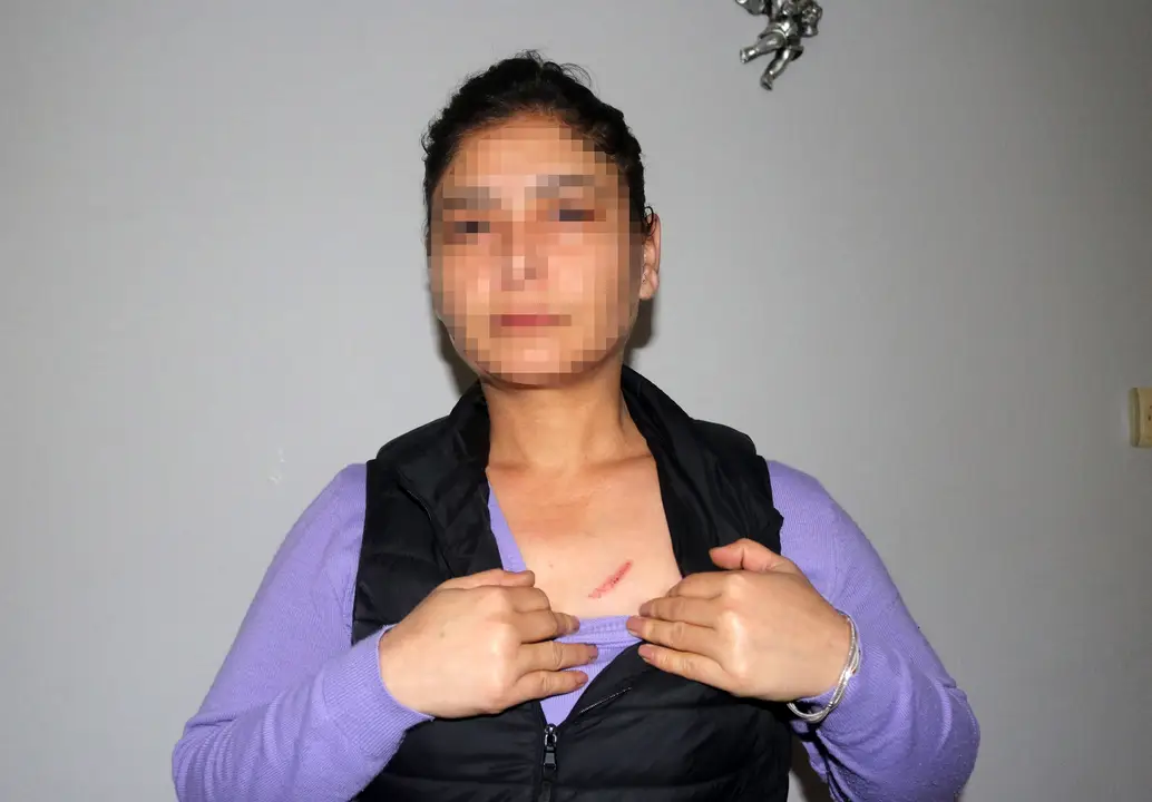 antalyada-korkunc-plan-elektrikle-komsusunu-oldurmeye-kalkti-4.webp