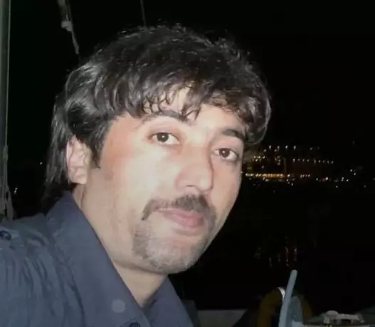 skudarda-kan-donduran-olay-esi-uyurken-kizgin-yag-doktu.webp