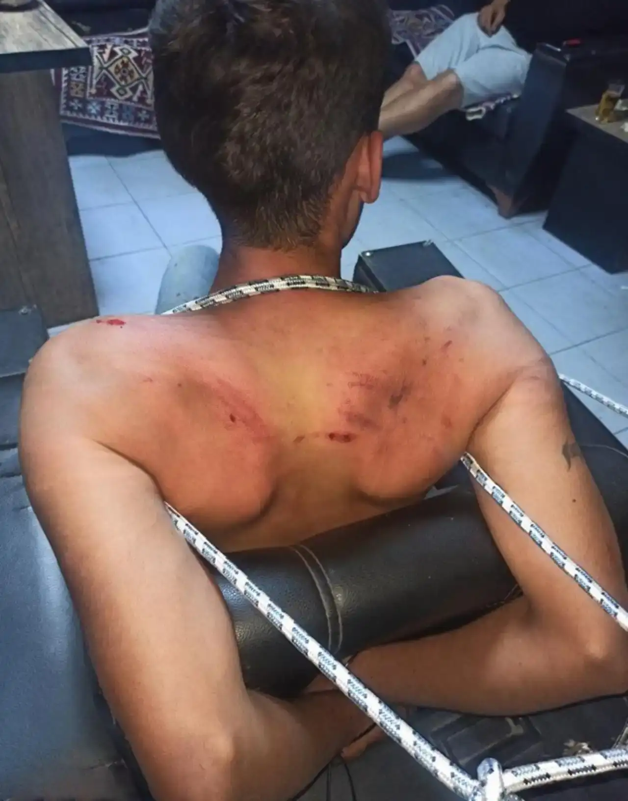 antalyada-hamam-bocegi-yedirip-iskence-edilen-gencin-davasinda-karar-cikti-gazete