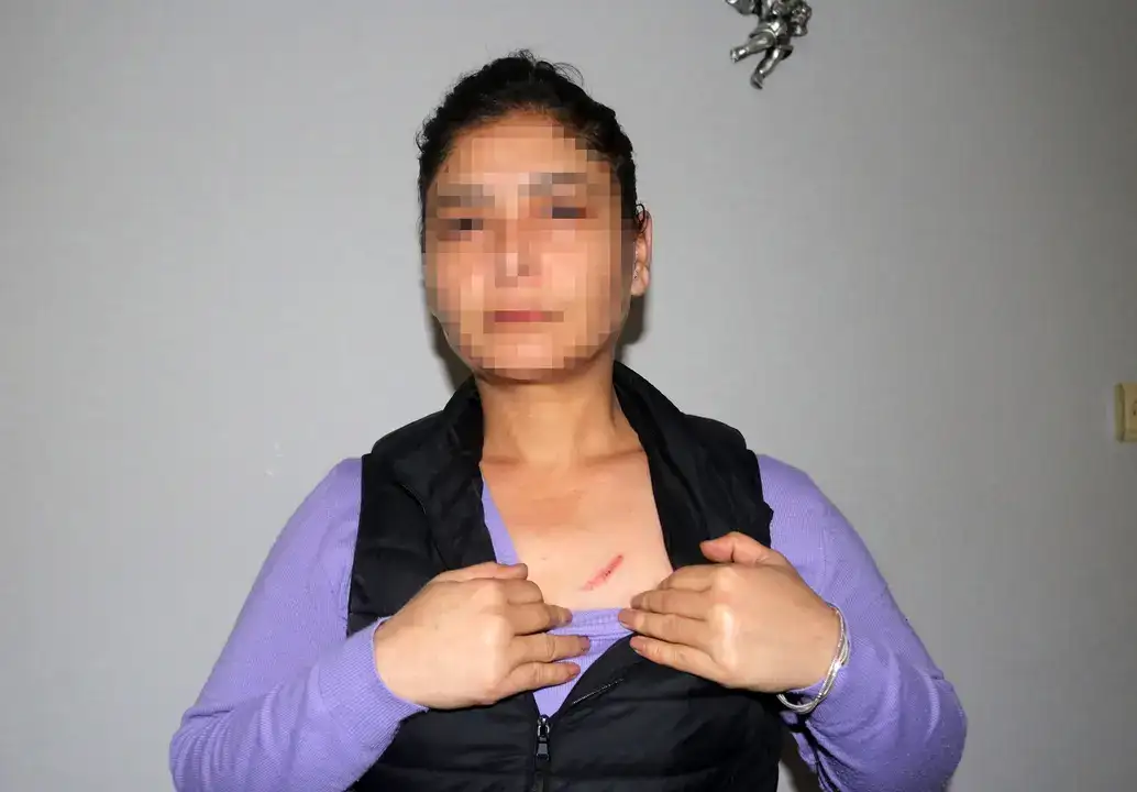 muratpasada-elektrikli-duzenekle-saldirdi-13-yil-hapis-cezasi-aldi