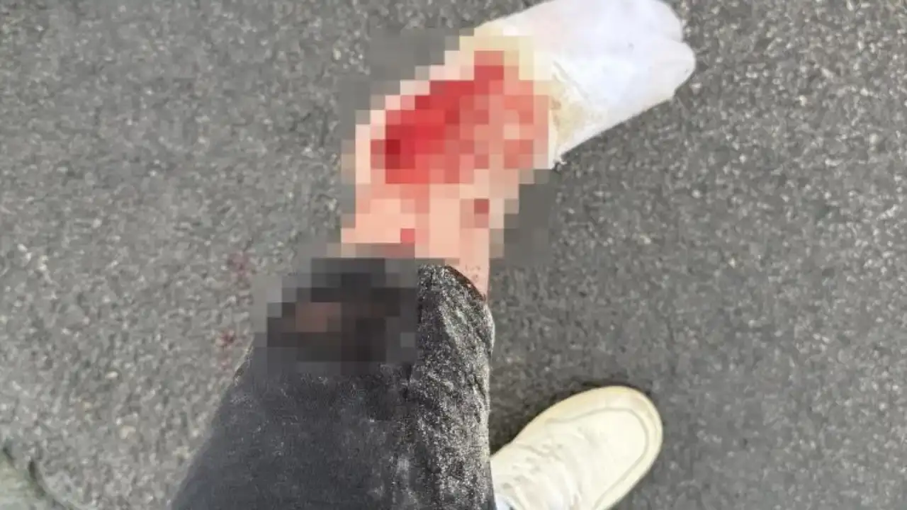 antalyada-10-kisinin-oldugu-kazadan-sag-cikti-universite-ogrencisi-o-anlari-anlatti