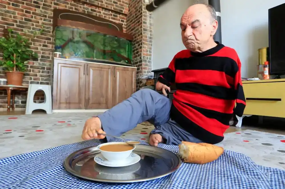 antalyada-azmiyle-gorenleri-sasirtiyor-elleri-olmadan-ayaklariyla-tutunuyor